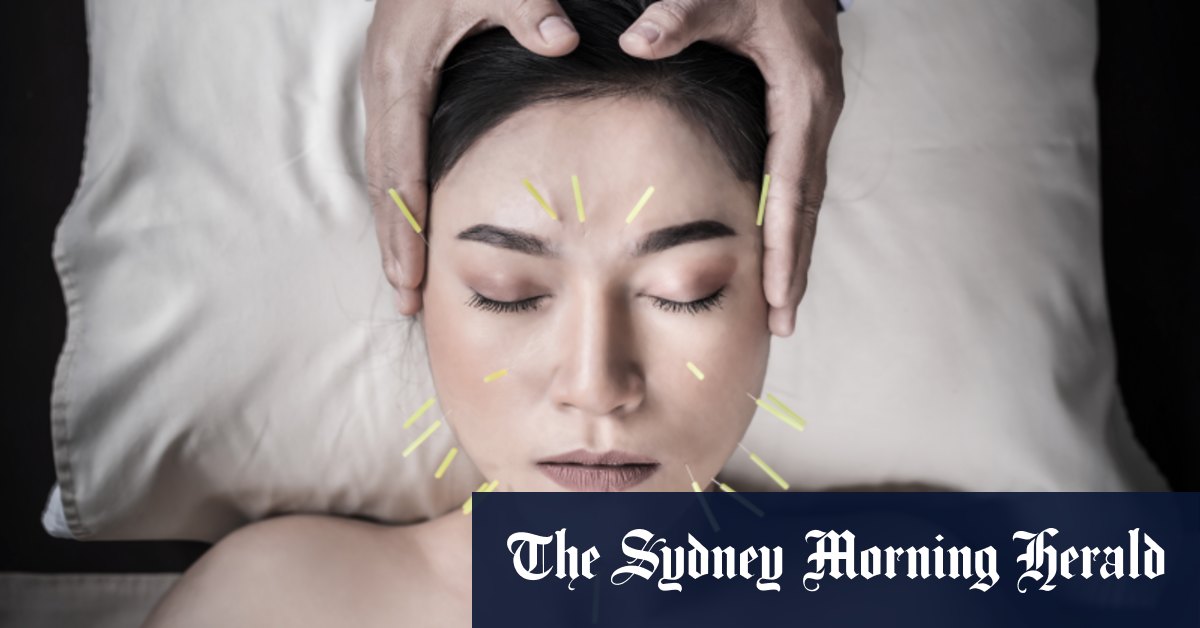 L'acupuncture esthétique est-elle meilleure que le Botox ?