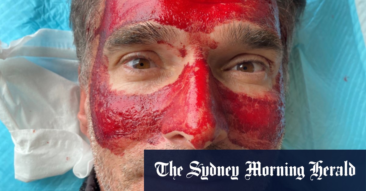 La nouvelle série de bien-être Mirror Mirror de Todd Sampson s'attaque à Gwyneth Paltrow et Miranda Kerr