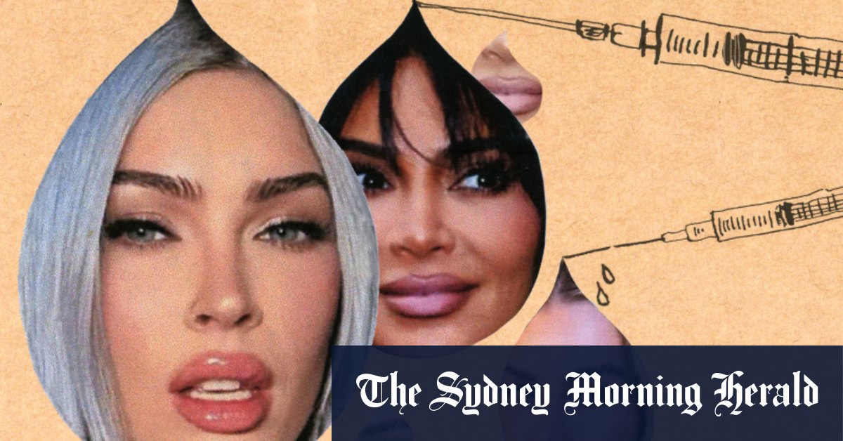J'ai eu du Botox sur mon front et Keira Knightley en bougeant son front m'a arrêté net.