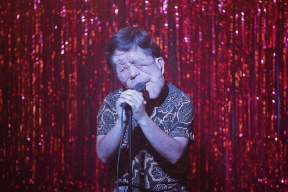 « Les deux façons les plus simples de perdre votre anonymat dans la société sont d’être défiguré ou d’être une célébrité » : Adam Pearson dans A Different Man.