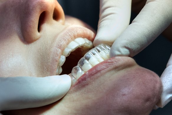 Pour ceux qui veulent un traitement orthodontique plus subtil, les aligneurs sont une option viable.