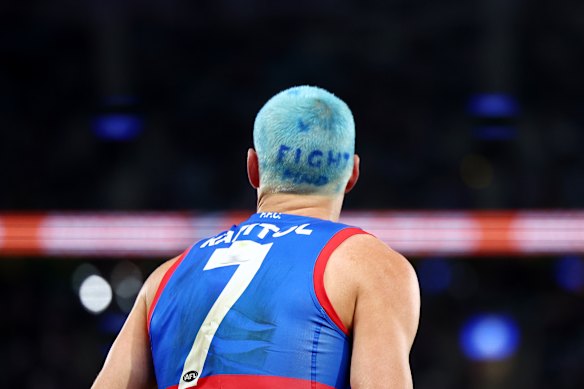 Rory Lobb a teint ses cheveux en bleu pour combattre Mnd.