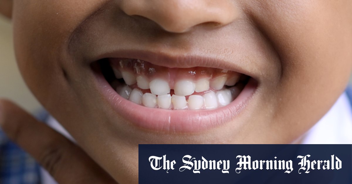 Pourquoi votre tout-petit doit un voyage au dentiste