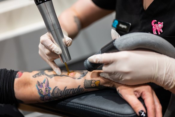 La chaîne mondiale d'élimination des tatouages Reopovery dit qu'elle a vu une croissance de 35% des traitements au cours de la dernière année.