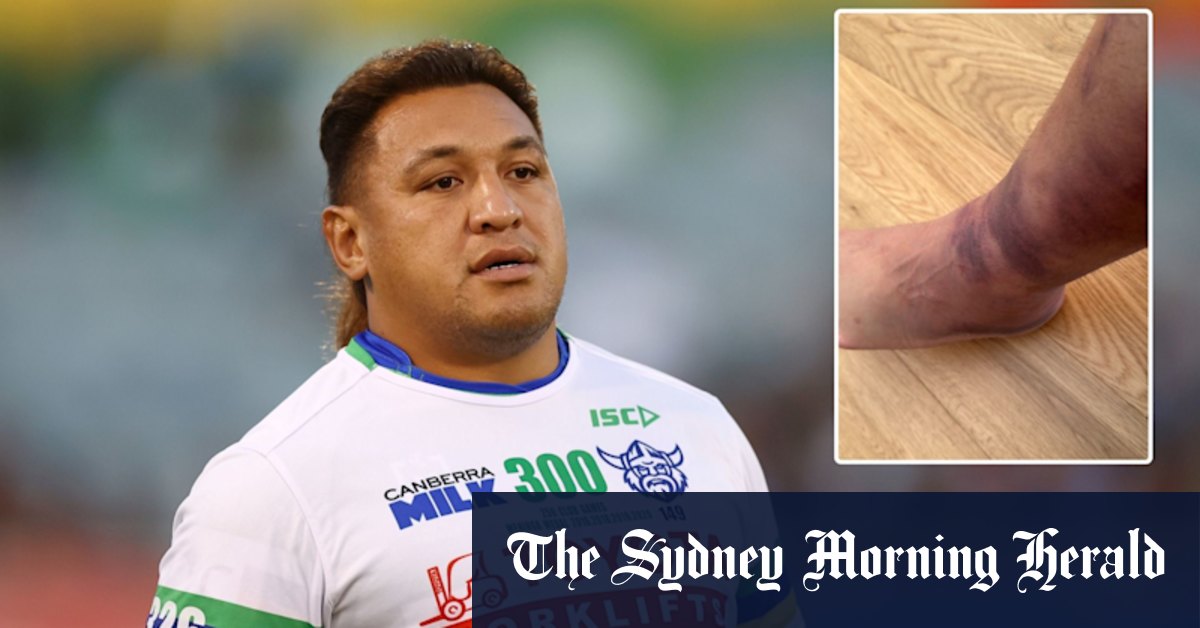 L'application des Raiders Josh Papalii révèle la peur des blessures à la cheville avant la finale de qualification des Broncos