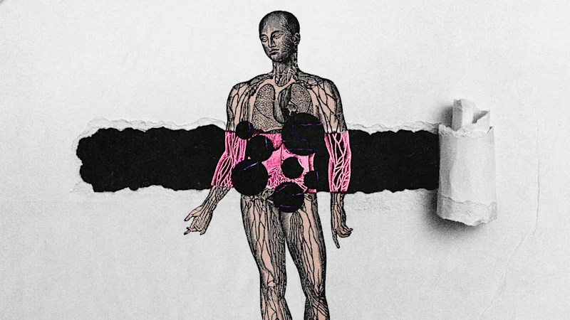 Les cancers « silencieux » en augmentation sont souvent détectés trop tard