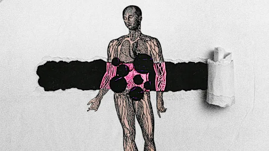 Certains cancers sont plus faciles à diagnostiquer que d’autres. Et certains symptômes sont comme un murmure, facilement ignorés par les professionnels de la santé.