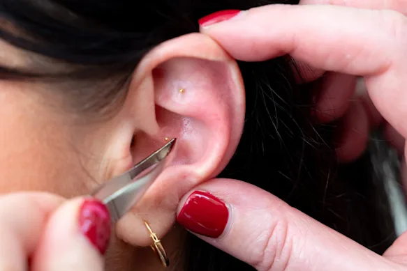 L’ensemencement des oreilles fait fureur sur TikTok actuellement, mais fait-il réellement ce que prétendent ses partisans ?