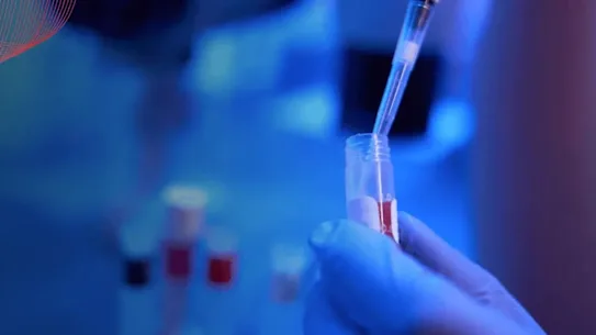 Les malheurs de CSL s'étendent au secteur du plasma, qui génère la majeure partie de ses bénéfices. 