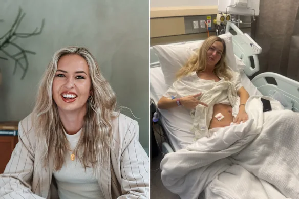 En janvier 2026, la mannequin et défenseure de la continence Anja Christoffersen a subi une opération d'appendicostomie (à droite), une procédure qui lui permet d'évacuer ses bols via le gros côlon.