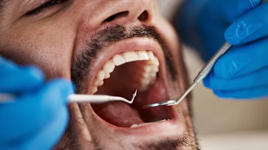 Quelqu'un a-t-il envie d'une visite chez le dentiste ? Cela pourrait signifier une meilleure santé cardiaque. 