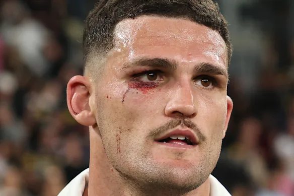 Nathan Cleary a franchi la barrière de la douleur lors de la victoire 19-12 de Penrith contre les Roosters.