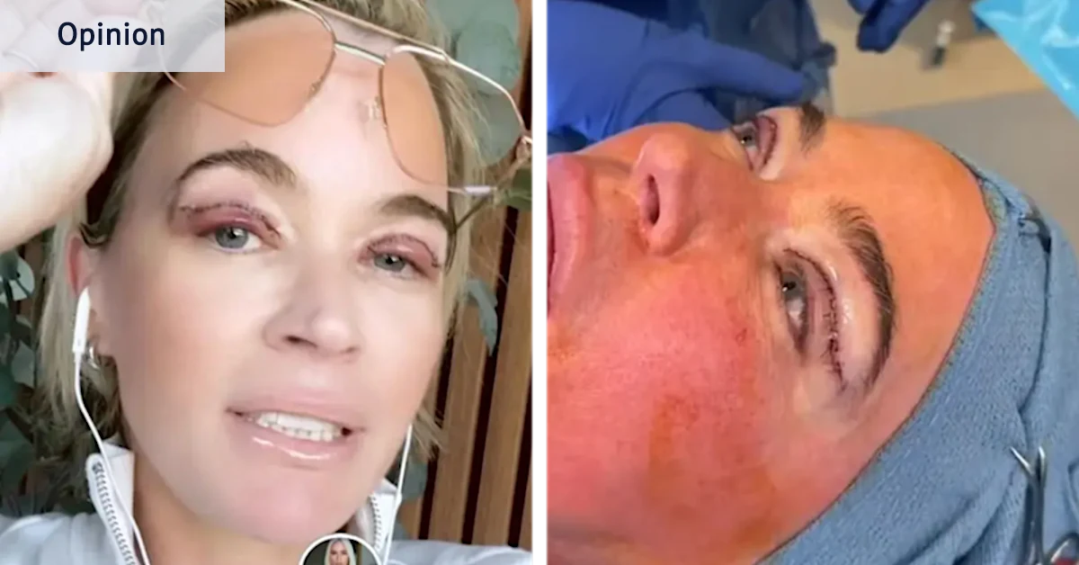 Teddi Mellencamp a subi une chirurgie esthétique lorsqu'elle suivait une chimio. j'ai fait pareil